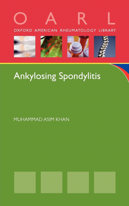 ANKYLOSING SPONDYLITIS