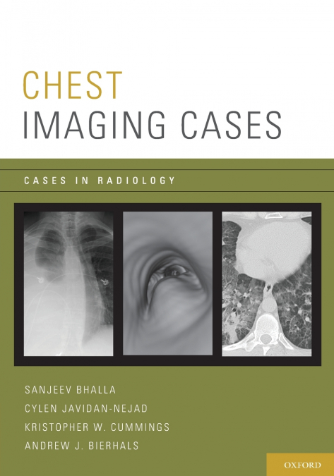 CHEST IMAGING CASES