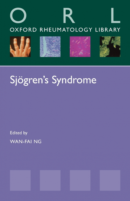SJOGREN?S SYNDROME
