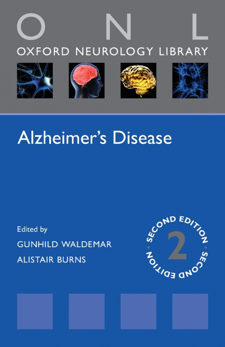 ALZHEIMER?S DISEASE