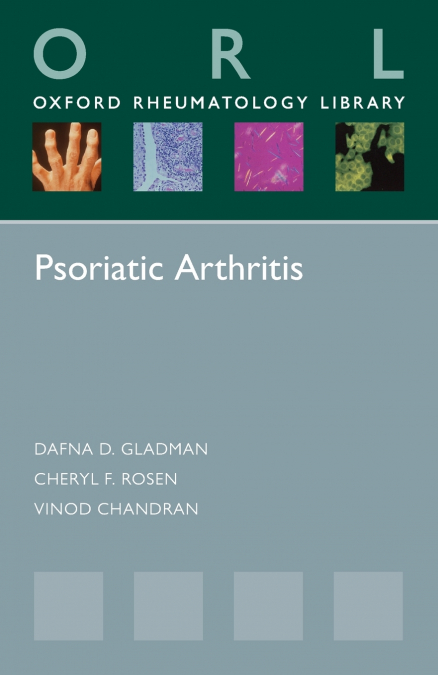 PSORIATIC ARTHRITIS