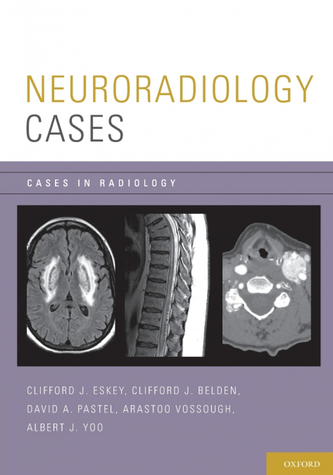 NEURORADIOLOGY CASES