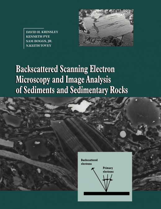 BACKSCATTERED SCANNING ELECTRON MICROSCOPY AND IMAGE ANALYSI