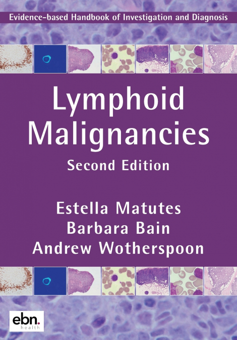 LYMPHOID MALIGNANCIES