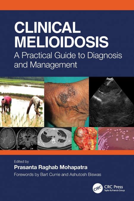 CLINICAL MELIOIDOSIS