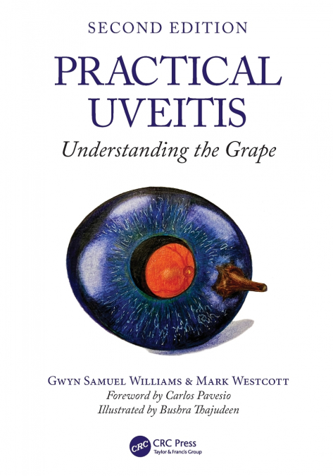 PRACTICAL UVEITIS