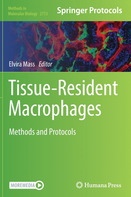 TISSUE-RESIDENT MACROPHAGES