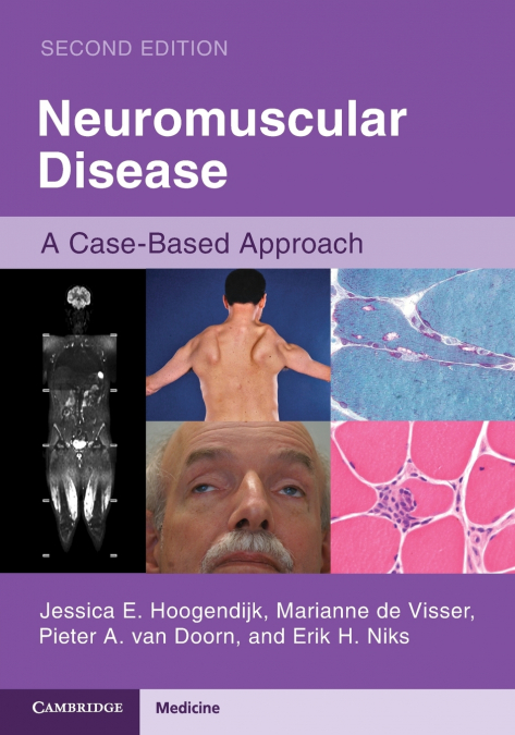 NEUROMUSCULAR DISEASE