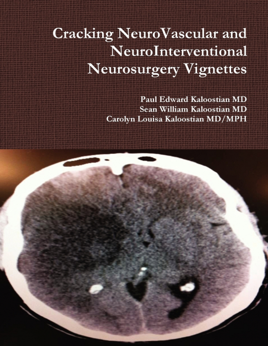 CRACKING NEUROVASCULAR AND NEUROINTERVENTIONAL NEUROSURGERY