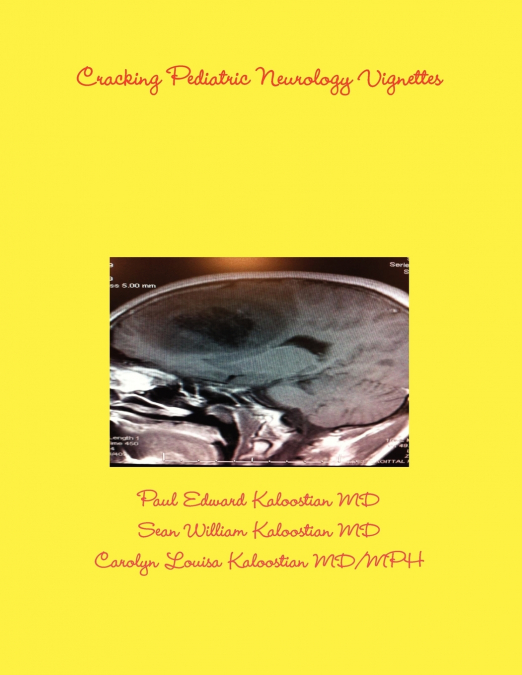 CRACKING PEDIATRIC NEUROLOGY VIGNETTES