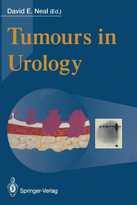 TUMOURS IN UROLOGY