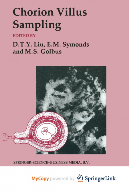 CHORION VILLUS SAMPLING