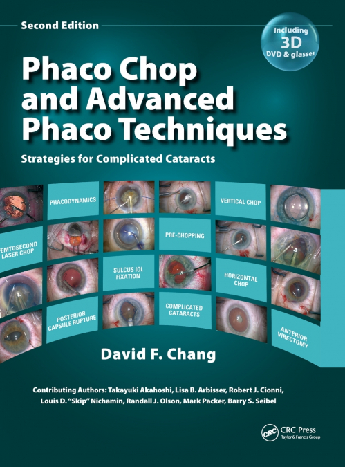 PHACO CHOP AND ADVANCED PHACO TECHNIQUES
