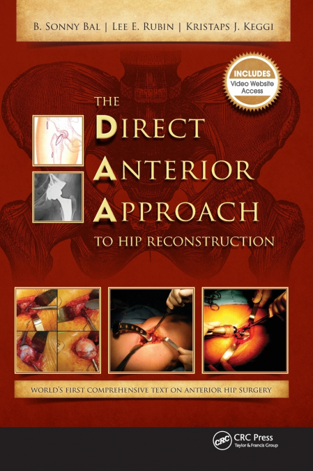 THE DIRECT ANTERIOR APPROACH TO HIP RECONSTRUCTION