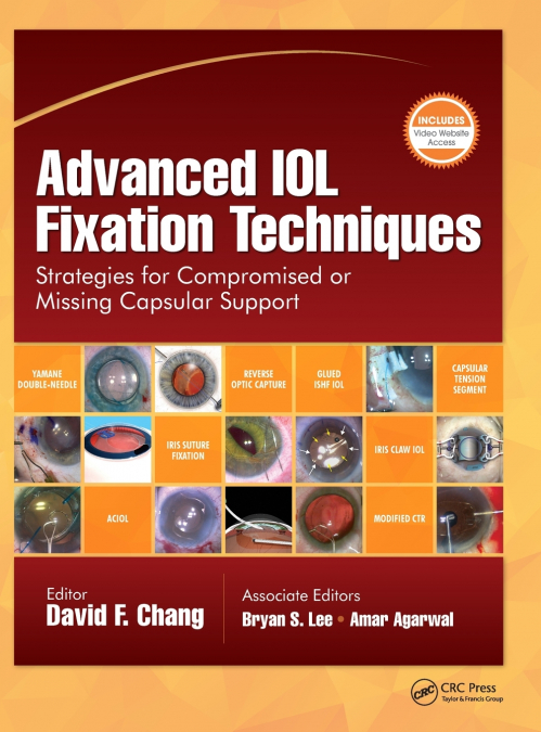 ADVANCED IOL FIXATION TECHNIQUES