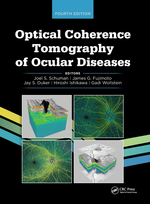 OPTICAL COHERENCE TOMOGRAPHY OF OCULAR DISEASES