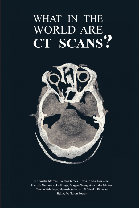 WHAT IN THE WORLD ARE CT SCANS?