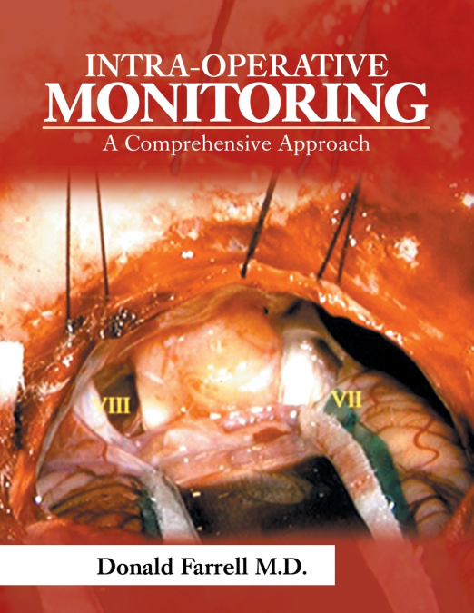 INTRA-OPERATIVE MONITORING