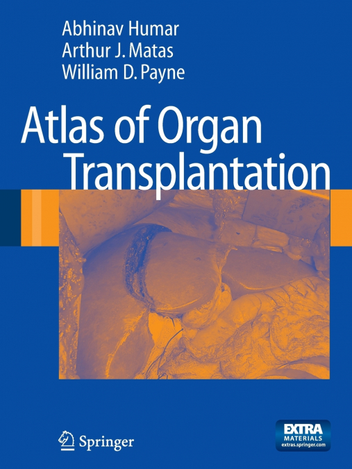 ATLAS OF ORGAN TRANSPLANTATION
