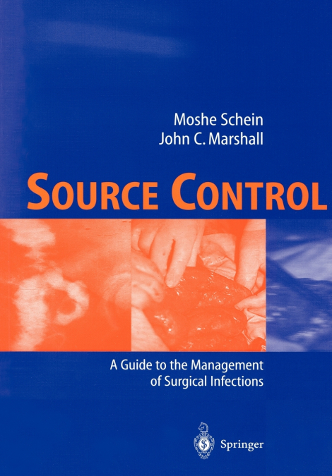 SOURCE CONTROL