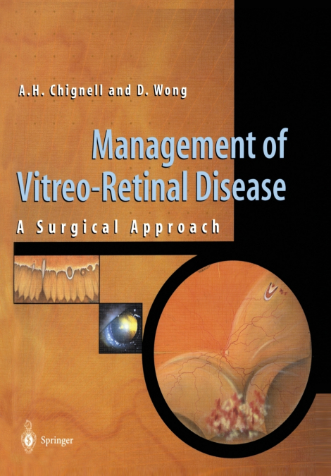 MANAGEMENT OF VITREO-RETINAL DISEASE