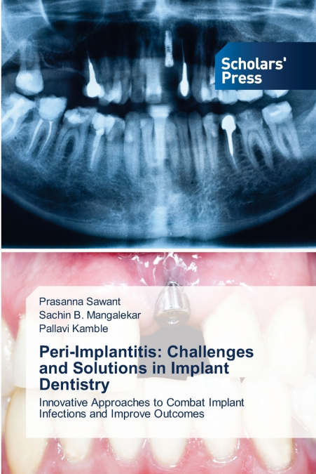 PERI-IMPLANTITIS