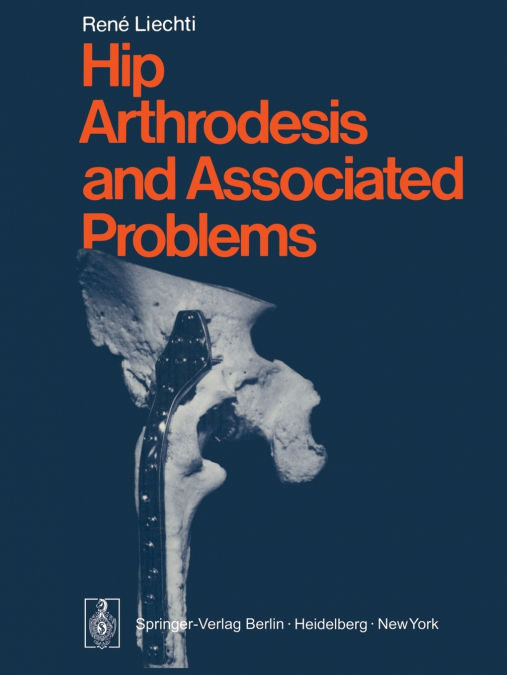 HIP ARTHRODESIS AND ASSOCIATED PROBLEMS