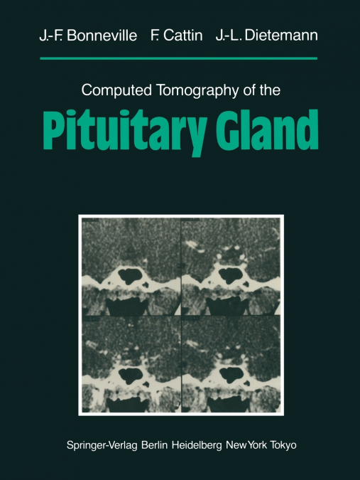 COMPUTED TOMOGRAPHY OF THE PITUITARY GLAND