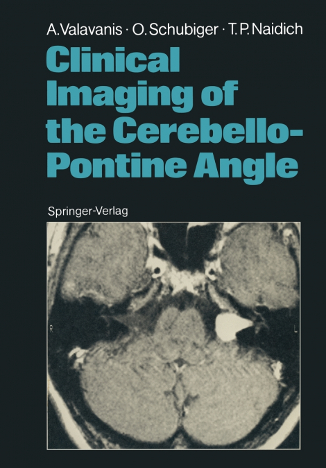 CLINICAL IMAGING OF THE CEREBELLO-PONTINE ANGLE