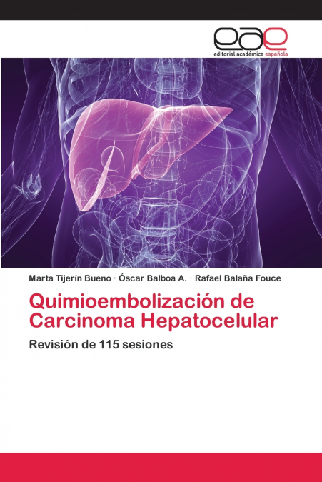 QUIMIOEMBOLIZACION DE CARCINOMA HEPATOCELULAR