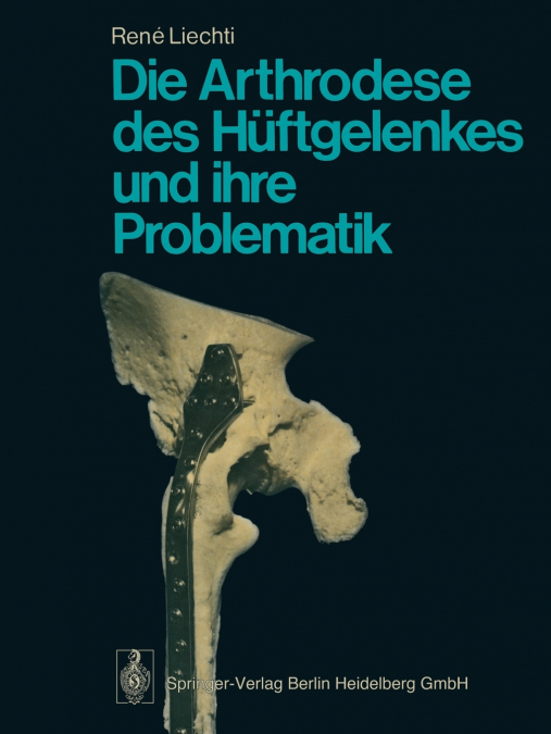 DIE ARTHRODESE DES HUFTGELENKES UND IHRE PROBLEMATIK