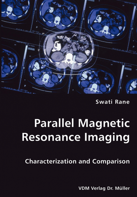 PARALLEL MAGNETIC RESONANCE IMAGING