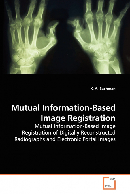 MUTUAL INFORMATION-BASED IMAGE REGISTRATION