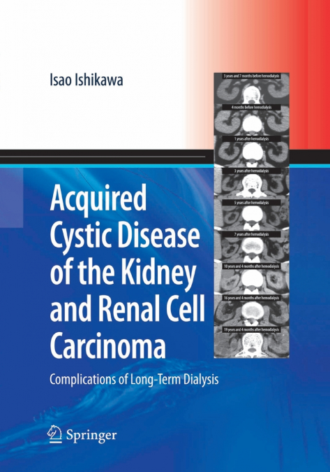 ACQUIRED CYSTIC DISEASE OF THE KIDNEY AND RENAL CELL CARCINO