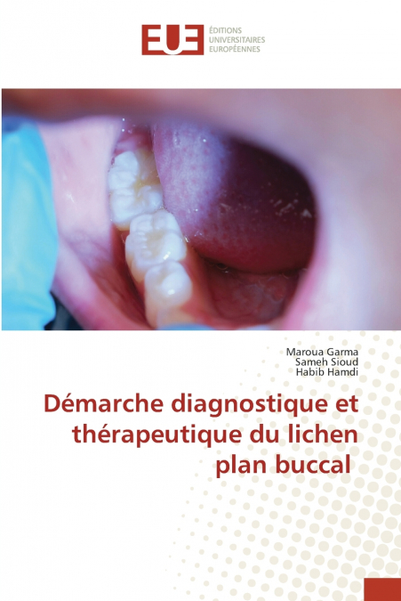 DEMARCHE DIAGNOSTIQUE ET THERAPEUTIQUE DU LICHEN PLAN BUCCAL