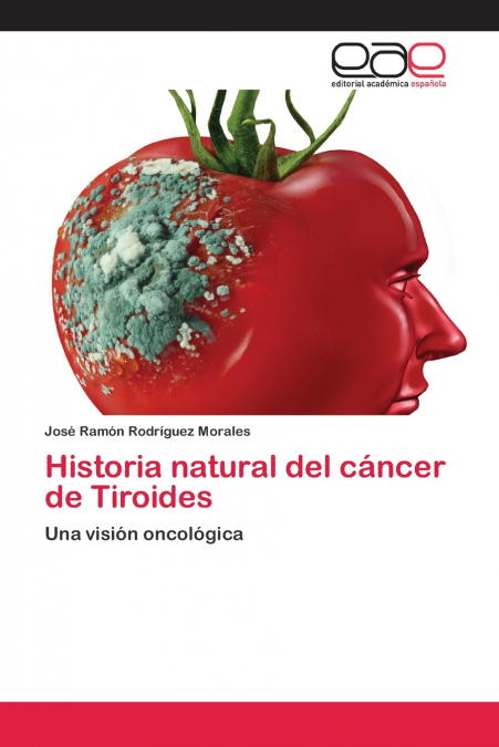 HISTORIA NATURAL DEL CANCER DE TIROIDES