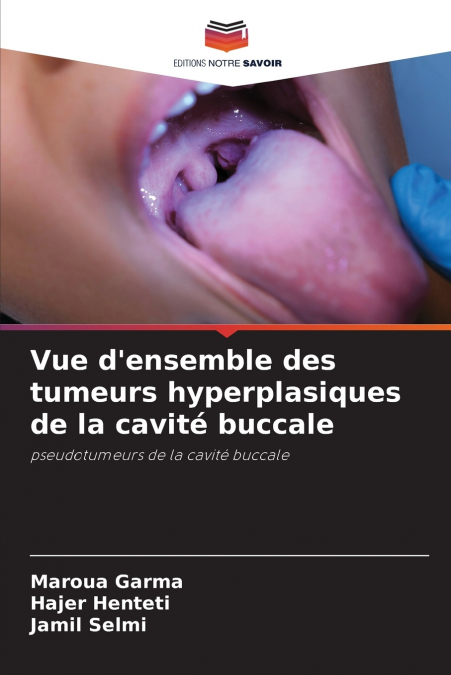 VUE D?ENSEMBLE DES TUMEURS HYPERPLASIQUES DE LA CAVITE BUCCA