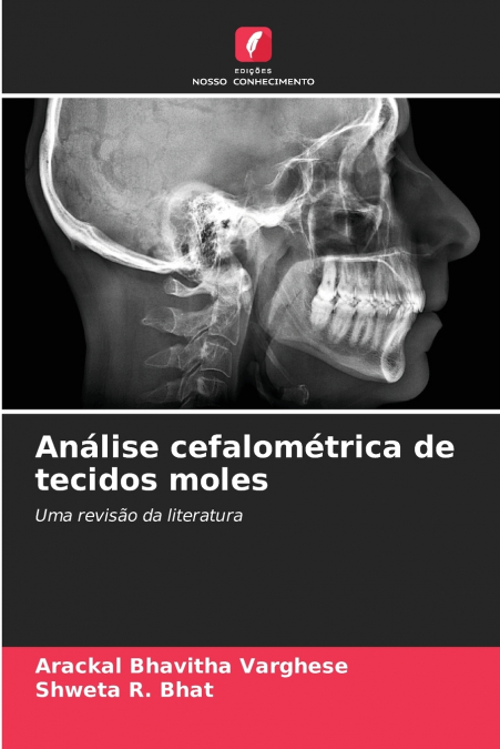 CEPHALOMETRIC SOFT TISSUE ANALYSIS