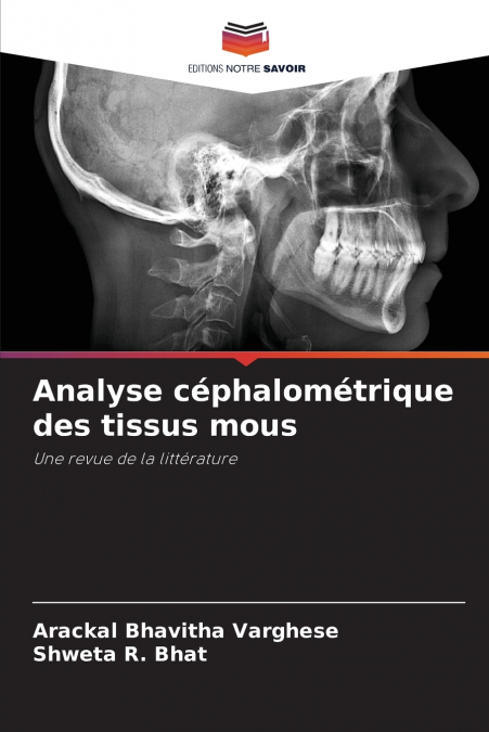 ANALYSE CEPHALOMETRIQUE DES TISSUS MOUS
