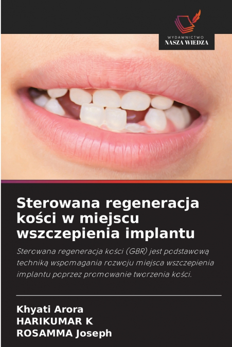 STEROWANA REGENERACJA KO?CI W MIEJSCU WSZCZEPIENIA IMPLANTU
