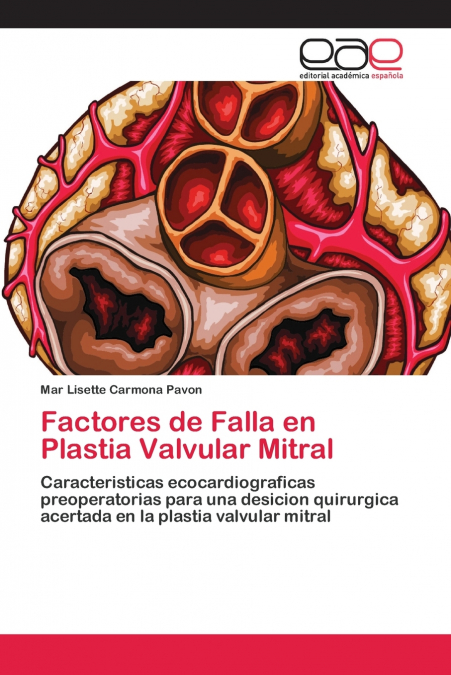 FACTORES DE FALLA EN PLASTIA VALVULAR MITRAL