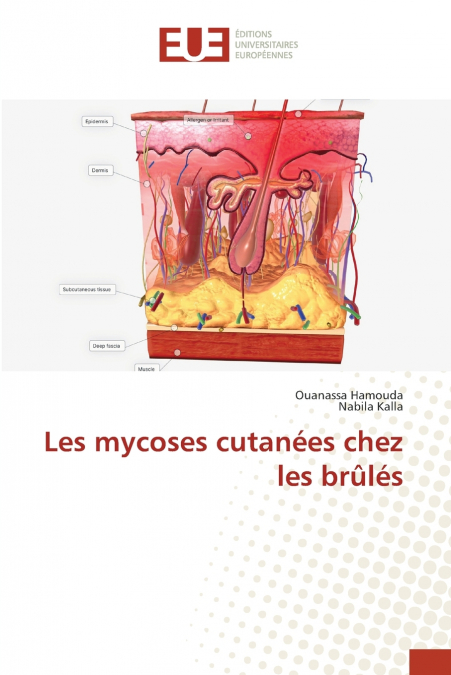 LES MYCOSES CUTANEES CHEZ LES BRULES