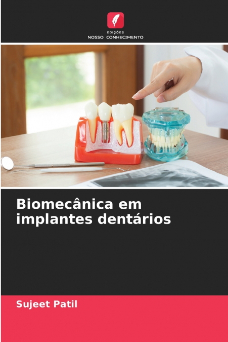 BIOMECANICA EM IMPLANTES DENTARIOS