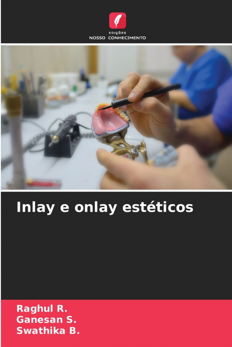 INLAY E ONLAY ESTETICOS