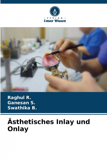 INLAY E ONLAY ESTETICOS