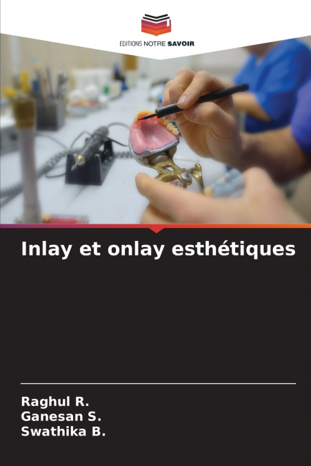 INLAY E ONLAY ESTETICOS