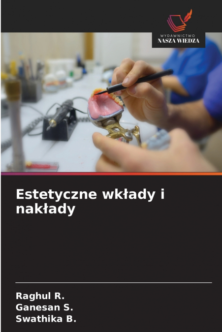 INLAY E ONLAY ESTETICOS