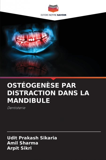 OSTEOGEN�SE PAR DISTRACTION DANS LA MANDIBULE
