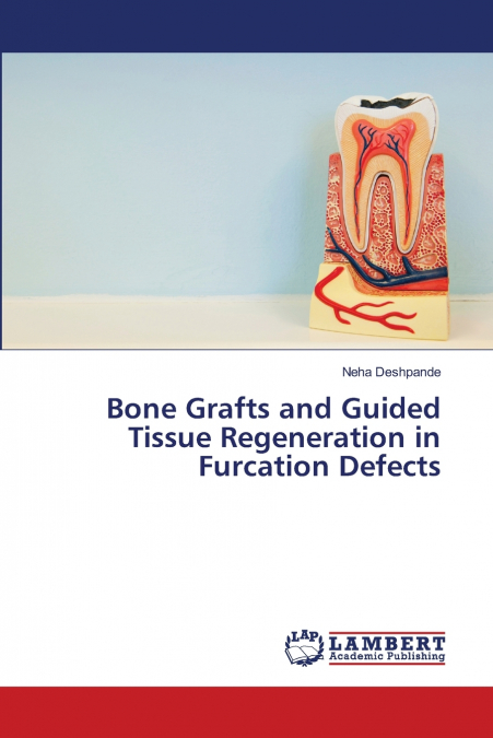BONE GRAFTS AND GUIDED TISSUE REGENERATION IN FURCATION DEFE