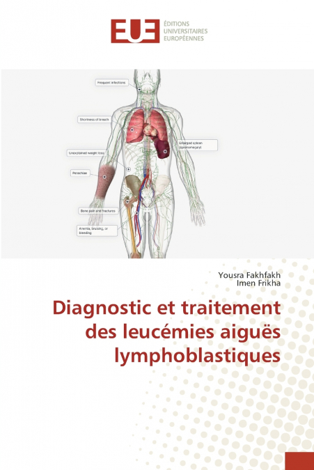 DIAGNOSTIC ET TRAITEMENT DES LEUCEMIES AIGUES LYMPHOBLASTIQU